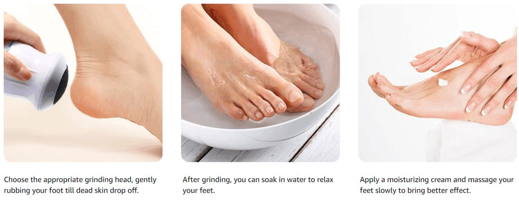 20 PCS Regular Coarse Replacement for Portable Electric Foot Grinder